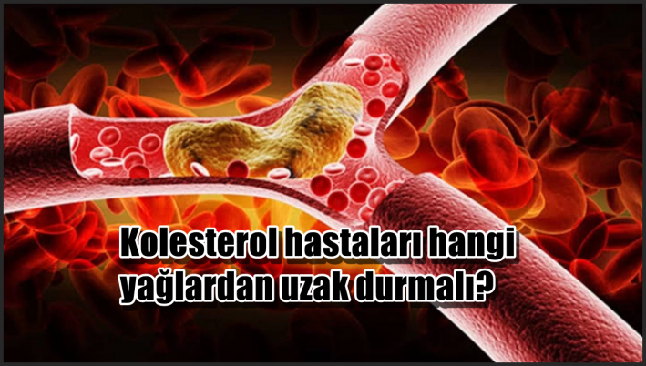 Kolesterol hastaları hangi yağlardan uzak durmalı.....