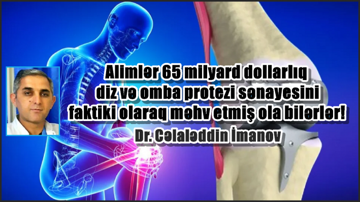 Alimlər 65 milyard dollarlıq diz və omba protezi sənayesini faktiki olaraq məhv etmiş ola bilərlər!