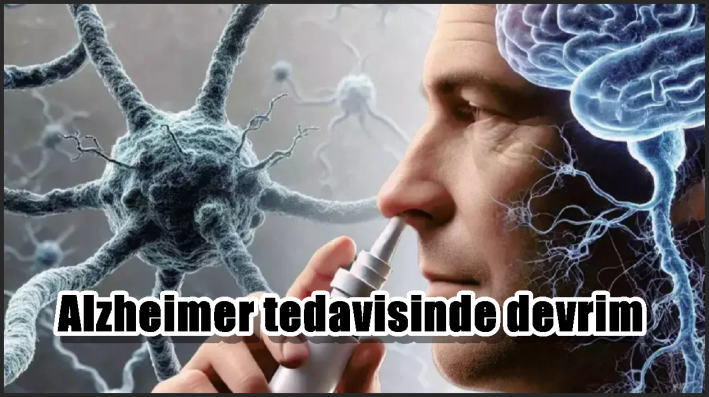 Alzheimer tedavisinde devrim